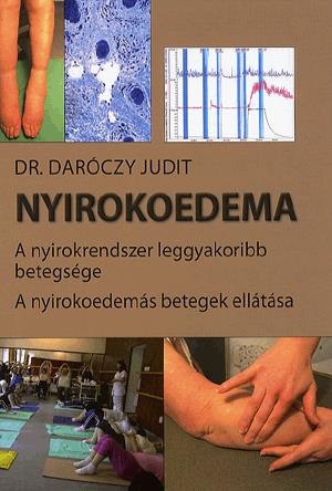 Nyirokoedema