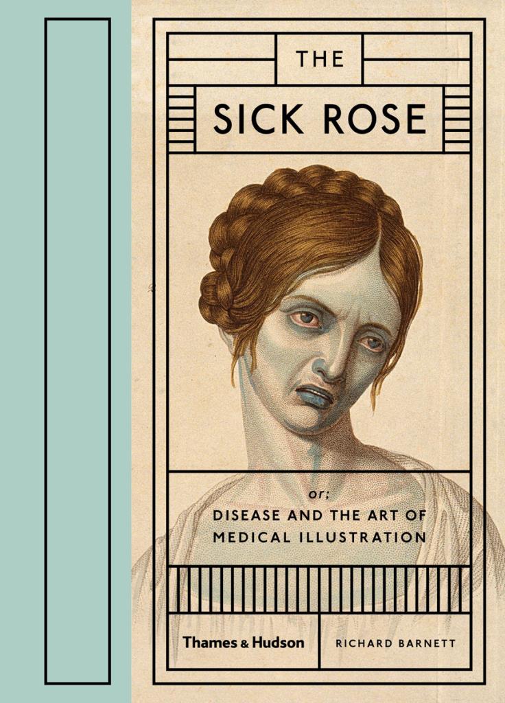 The Sick Rose - Or; Disease and the Art of Medical Illustration